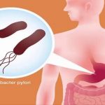Дієта при Хелікобактер пилори: Меню на тиждень для поліпшення самопочуття