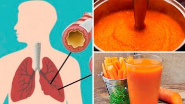 УНІКАЛЬНИЙ РЕЦЕПТ: Сироп, що допомагає очистити легені від мокроти та полегшити кашель