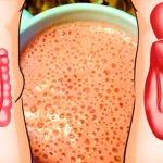 Тримайте кишківник у чистоті: 7 натуральних засобів для м’якого очищення