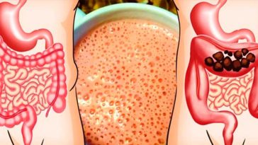 Тримайте кишківник у чистоті: 7 натуральних засобів для м’якого очищення