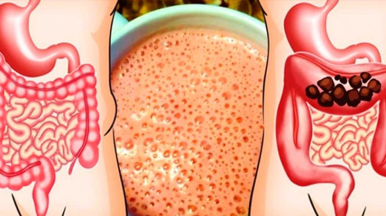 Тримайте кишківник у чистоті: 7 натуральних засобів для м’якого очищення