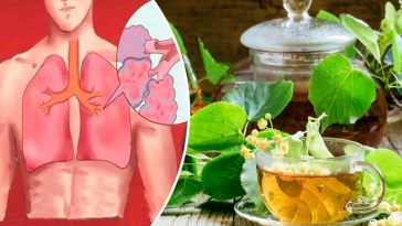 Липа — природне джерело здоров’я