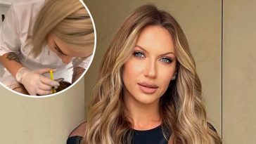 38-річна Леся Нікітюк освіжила зовнішність за допомогою філерів: косметологиня розкрила подробиці. Фото