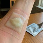 Найкращі гідроколоїдні пов’язки для опіків і хронічних ран